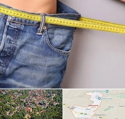 عمل لیپوماتیک در دماوند