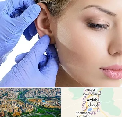 اتوپلاستی در اردبیل
