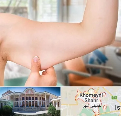براکیوپلاستی در خمینی شهر