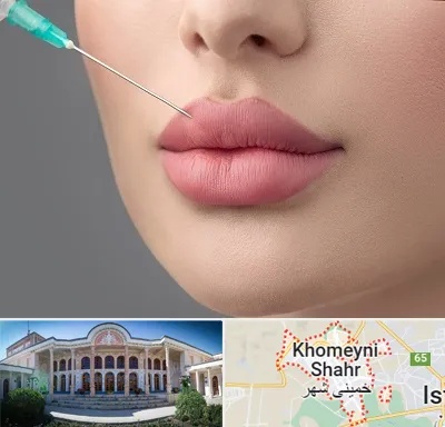 کلینیک ژل لب روسی در خمینی شهر