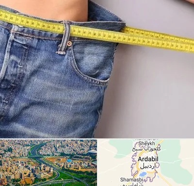 عمل لیپوماتیک در اردبیل