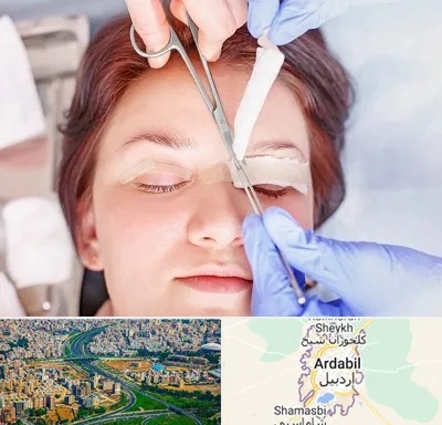 جراحی پلک افتاده در اردبیل