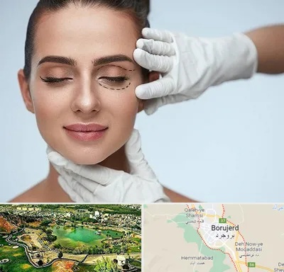 عمل پف چشم در بروجرد