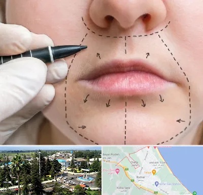 عمل سانترال لب در رودسر