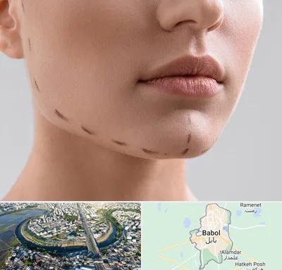عمل زاویه فک در بابل