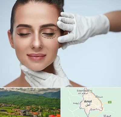 عمل پف چشم در آمل