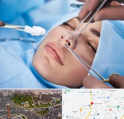 عمل ترمیمی بینی در سبلان 