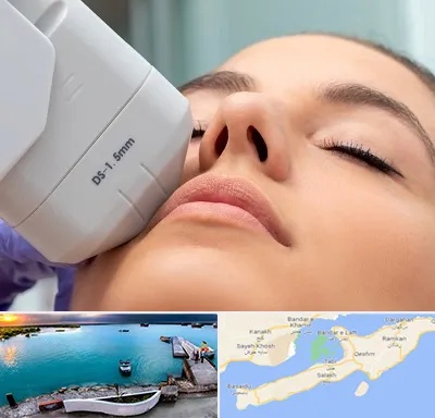 هایفوتراپی در قشم