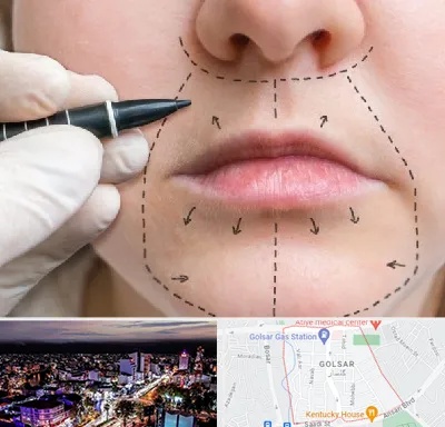 عمل سانترال لب در گلسار رشت 