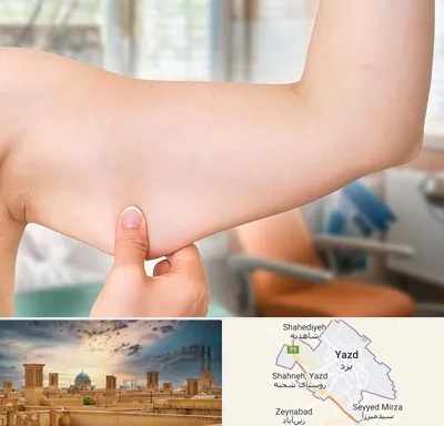 براکیوپلاستی در یزد