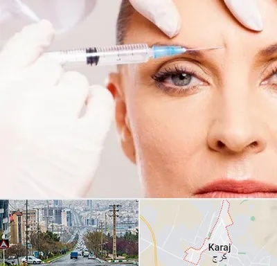مزوژل در گوهردشت کرج 