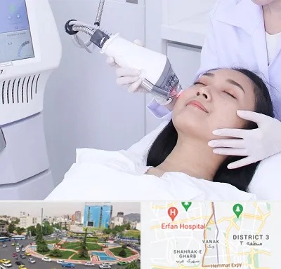 وایتنینگ در ونک 