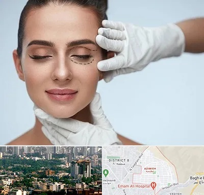 عمل پف چشم در عظیمیه کرج 