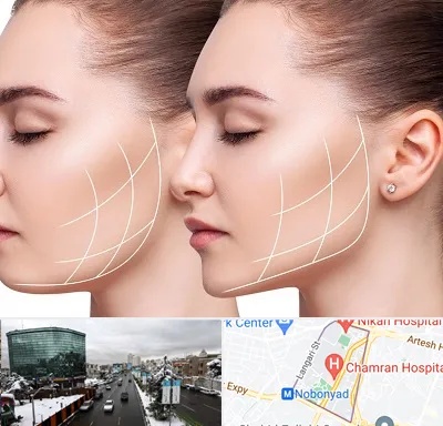 جراحی بوکال فت در اقدسیه 