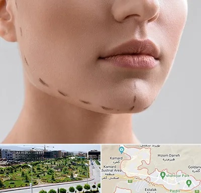عمل زاویه فک در پردیس