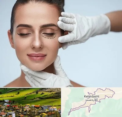 عمل پف چشم در کلاردشت
