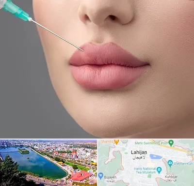 کلینیک ژل لب روسی در لاهیجان