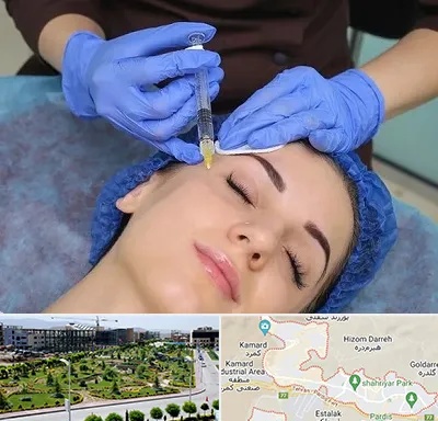 تزریق پروفایلو در پردیس