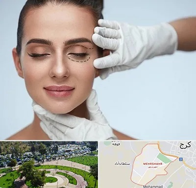 عمل پف چشم در مهرشهر کرج 