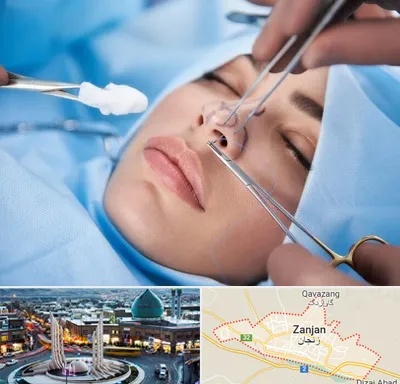 عمل ترمیمی بینی در زنجان