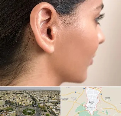 عمل گوش بل در قزوین