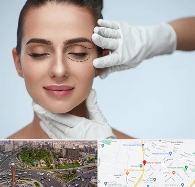 عمل پف چشم در سبلان 