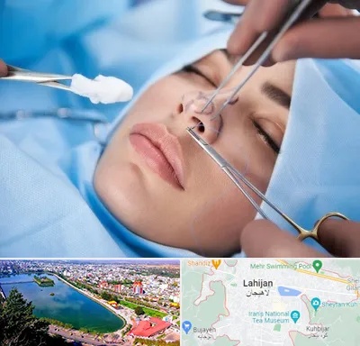 عمل ترمیمی بینی در لاهیجان