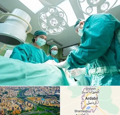 عمل تخلیه سینه در اردبیل