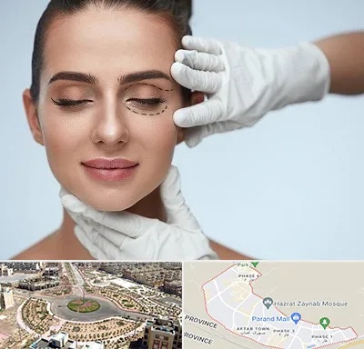 عمل پف چشم در پرند