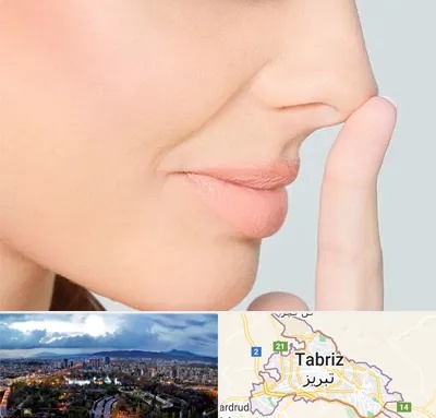 عمل تیپ پلاستی بینی در تبریز