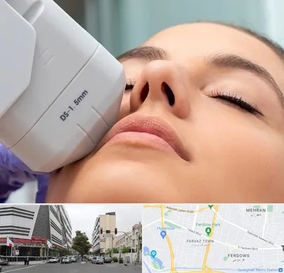هایفوتراپی در بلوار فردوس 