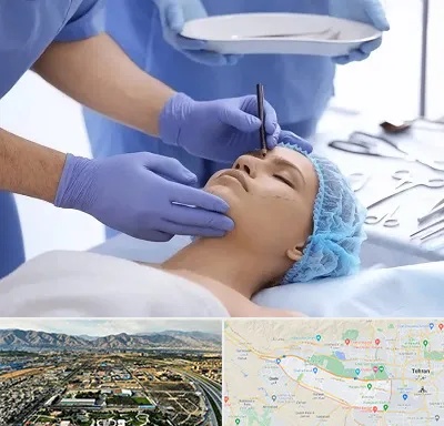 عمل بینی طبیعی در منطقه 21 تهران 