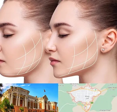 جراحی بوکال فت در خوی