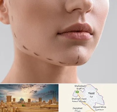 عمل زاویه فک در یزد
