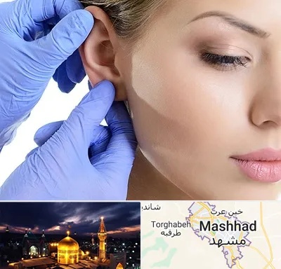اتوپلاستی در مشهد