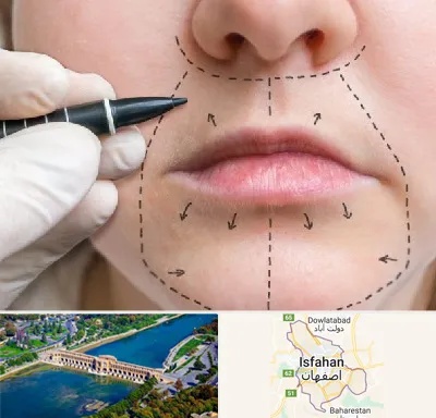 عمل سانترال لب در اصفهان