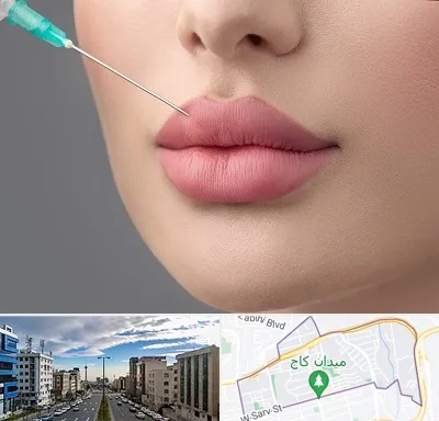 کلینیک ژل لب روسی در سعادت آباد 