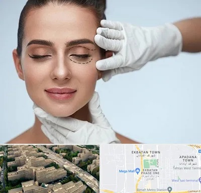 عمل پف چشم در اکباتان 