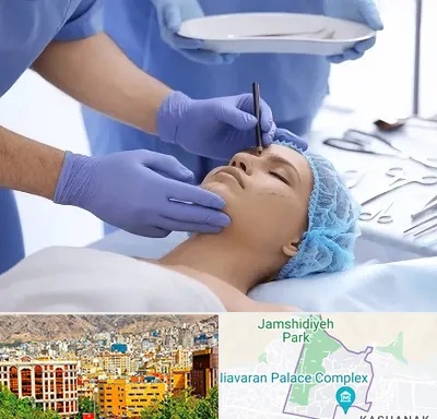 عمل بینی طبیعی در نیاوران 