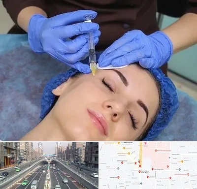 تزریق پروفایلو در توحید 