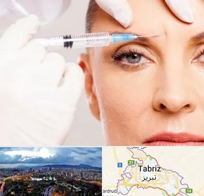 مزوژل در تبریز