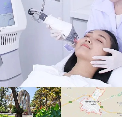 وایتنینگ در نیشابور