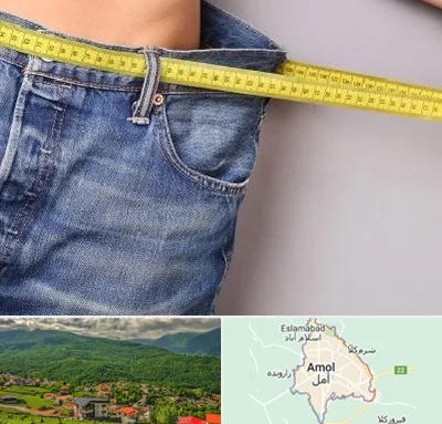 عمل لیپوماتیک در آمل
