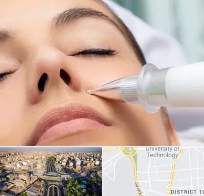 پلاسما جت بینی در استاد معین 