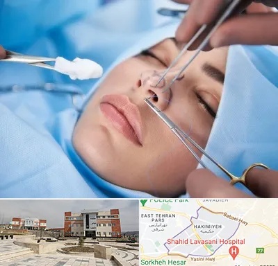 عمل ترمیمی بینی در حکیمیه 