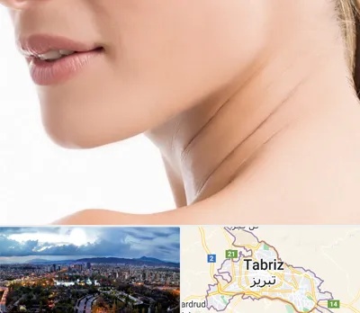 جراحی فک با لیزر در تبریز