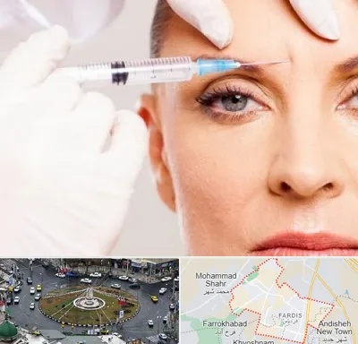 مزوژل در فردیس کرج 