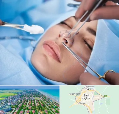 عمل ترمیمی بینی در ساری