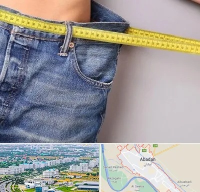عمل لیپوماتیک در آبادان