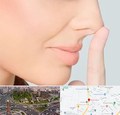 عمل تیپ پلاستی بینی در سبلان 